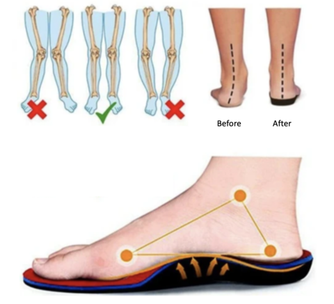 Clara™ | Comfort Orthopedic Sneakers